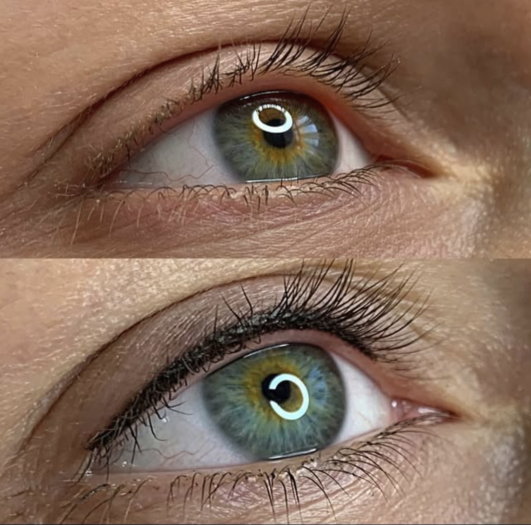 Lash Line Enhancement natural definition