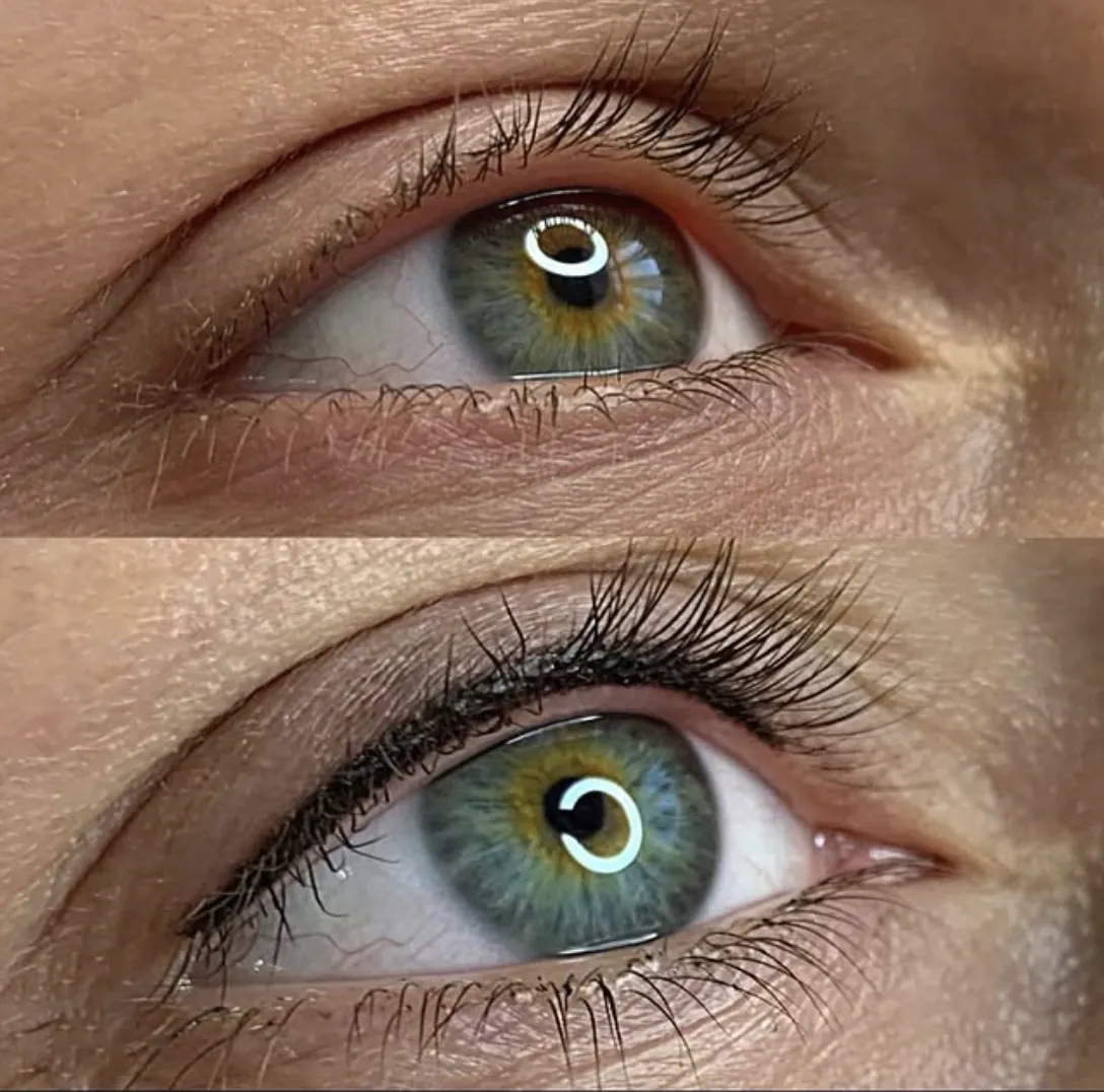 Lash Line Enhancement natural definition