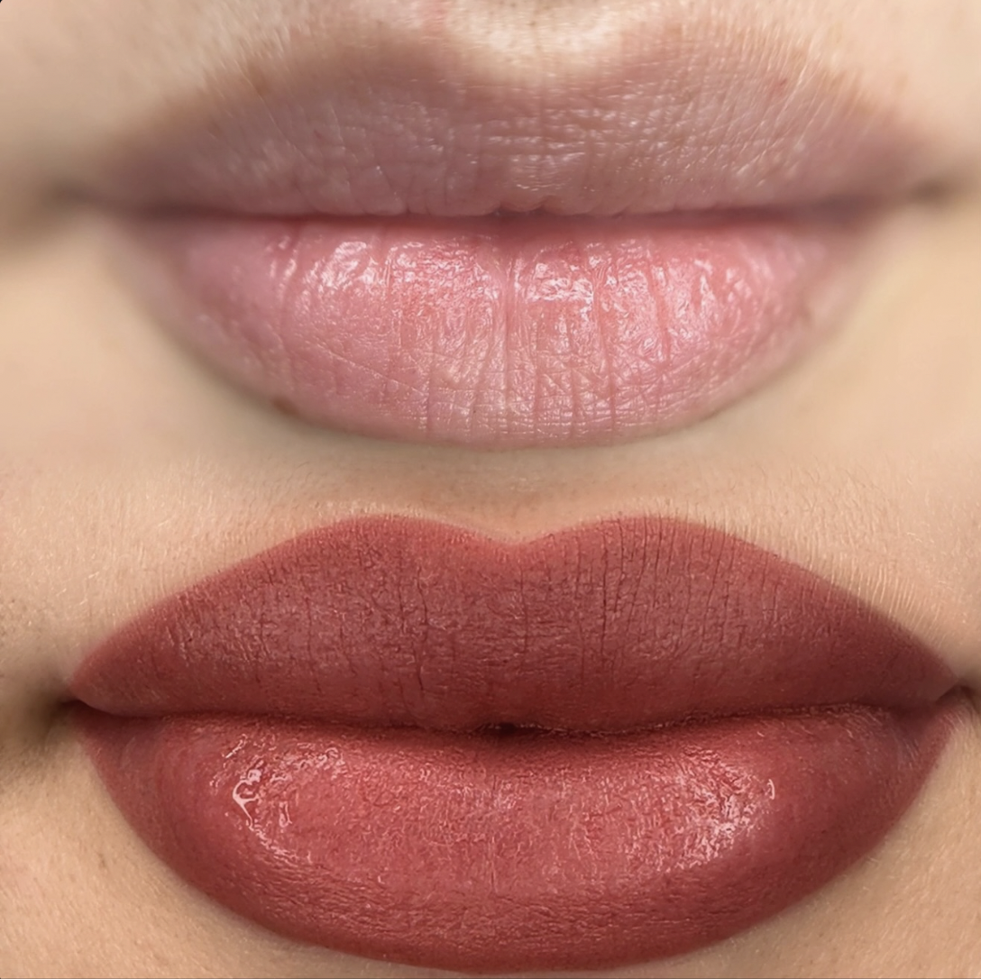 Lip Neutralization tone correction NYC